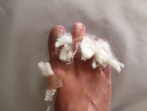 How to Use Trekkers Wool